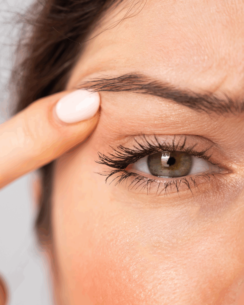Blefaroplastia párpados superiores